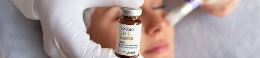 EXOSES